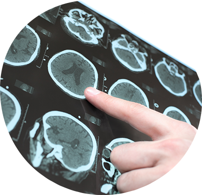 てんかん専門のクリニックです